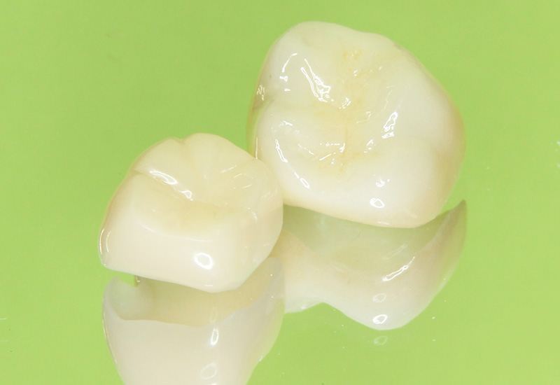 セラミック治療